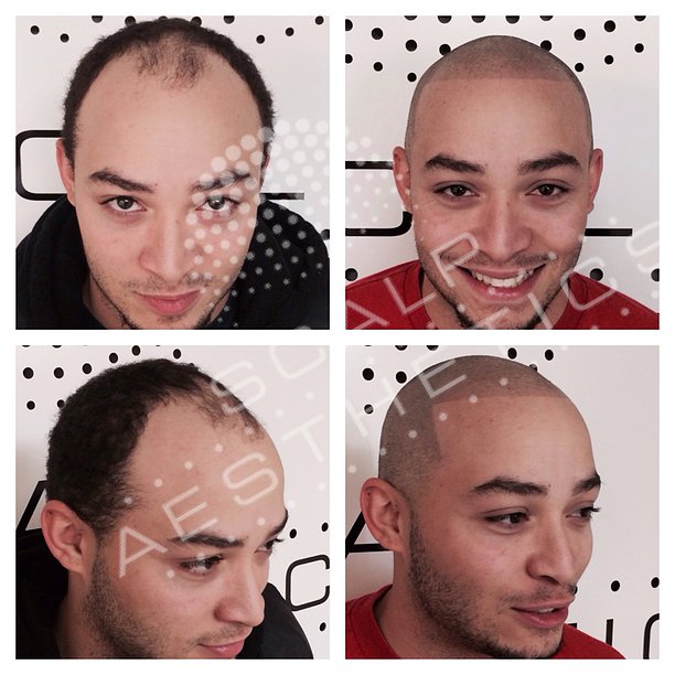 A Guide to Hairline Tattoos - Man of Many