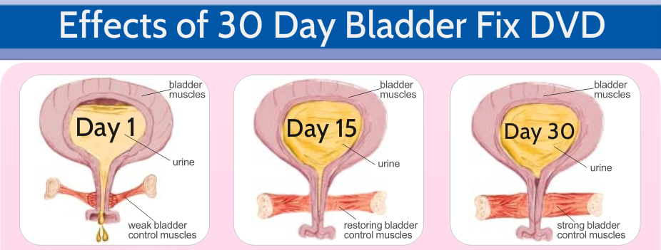 Pelvic Floor Exercises are More Than Kegels in 30 Day Bladder Fix DVD ...