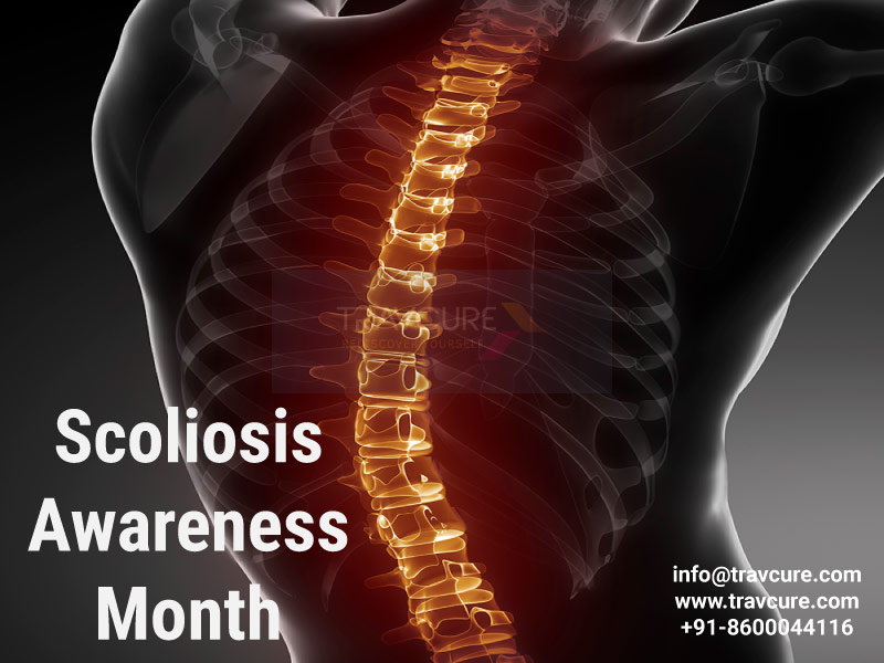 Scoliosis Awareness Month - June -- Travcure Medical Tourism | PRLog