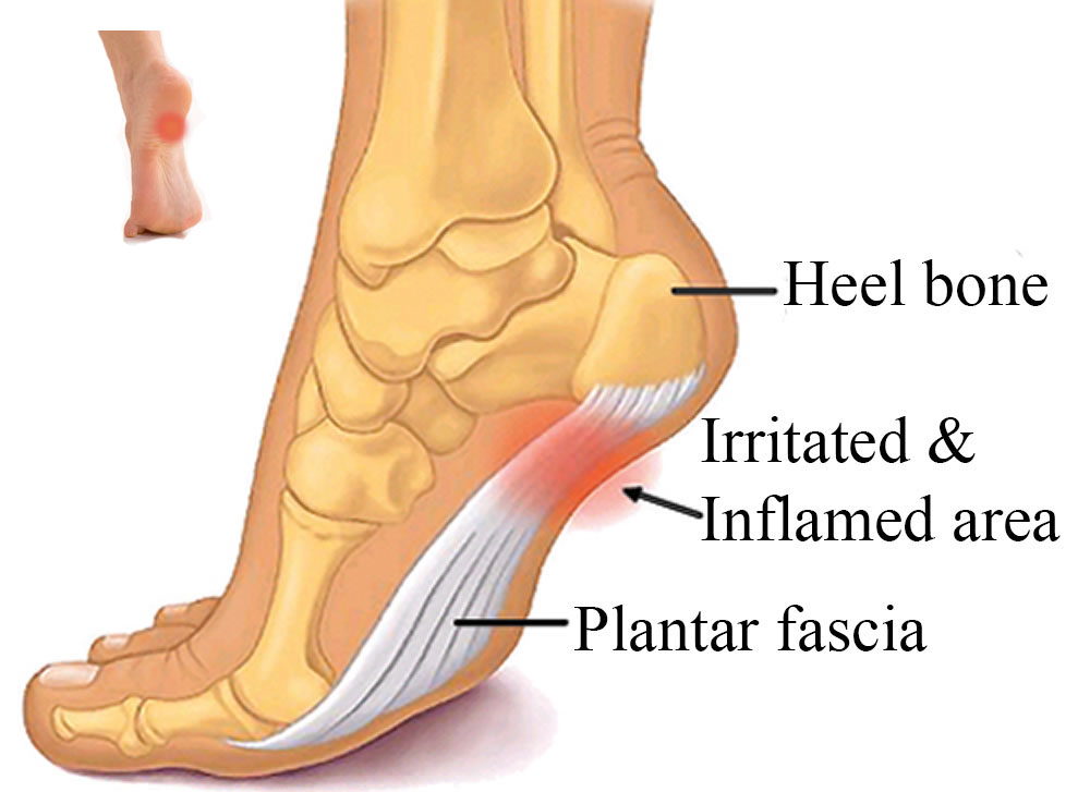 Common Foot Problems Pain - Traumatic Foot Injury -- Abigail store | PRLog