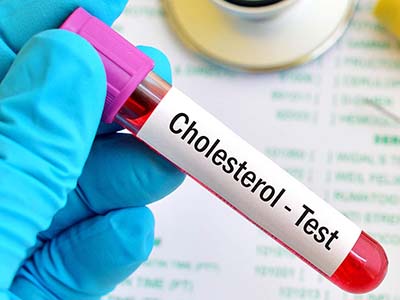 cholesterol market services test expected garner bn 2025 testing prlog triglycerides