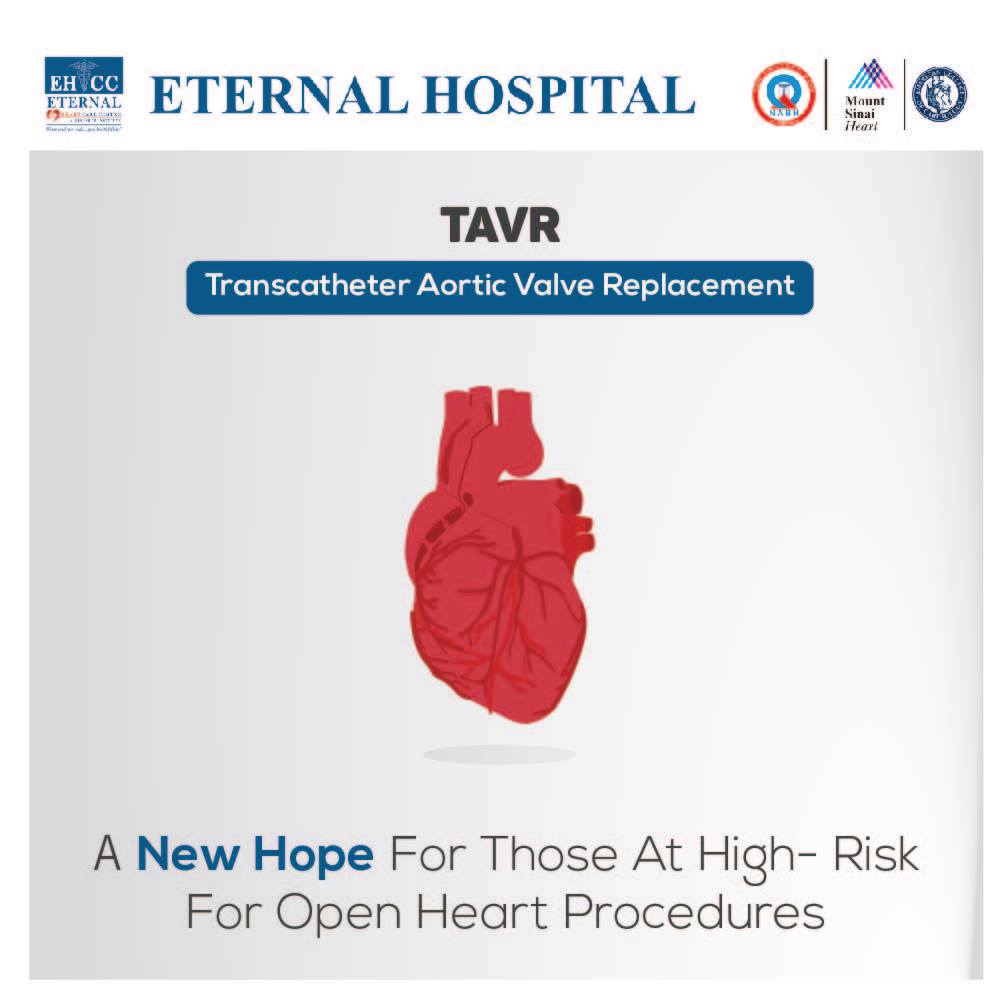 Get a New Heart with Transplant Surgery -- Eternal Hospital | PRLog