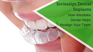 Invisalign Dental Implants – How Westlake Dental Helps Realign Your ...