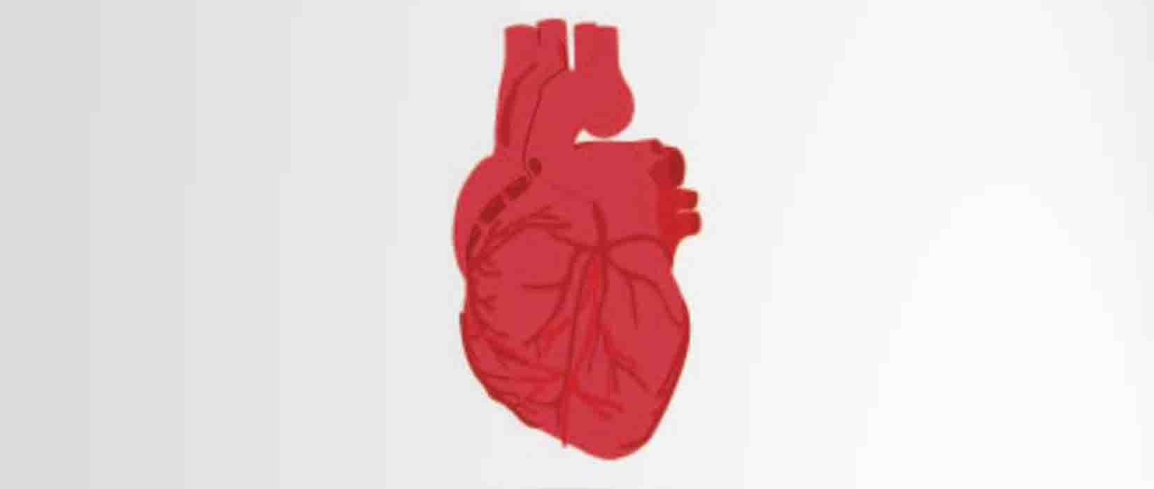 How Catheter Works in TAVI Surgery ? Heart Valve